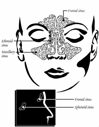 Normal Sinuses