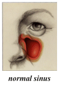 normal sinus